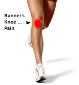 Gainesville Georgia Physical Therapy Knee Pain