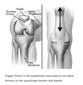 Gainesville Georgia Physical Therapy Runners Knee
